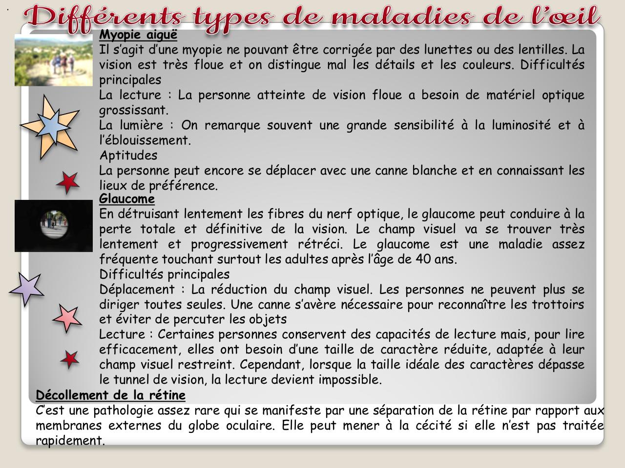 Aperçu du fichier PDF 5-livret-kipic-deficient-visuel-paule-girault.pdf